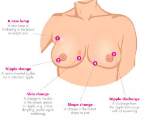 breast-change-diagram